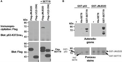 Methylation of the epigenetic JMJD2D protein by SET7/9 promotes prostate tumorigenesis